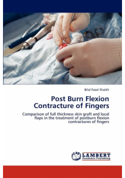 Post Burn Flexion Contracture of Fingers
