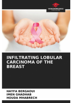 Infiltrating Lobular Carcinoma Of The Breast