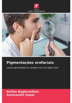 Pigmentações orofaciais