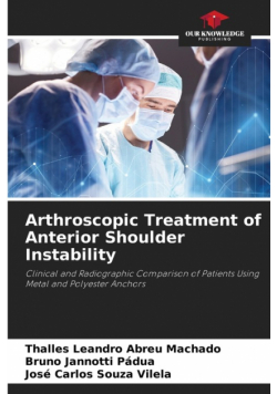 Arthroscopic Treatment of Anterior Shoulder Instability