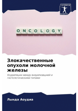 Злокачественные опухоли молочной железы