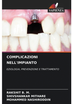 Complicazioni Nell'impianto