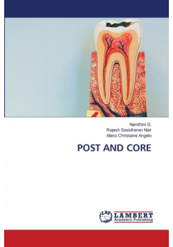 Post And Core