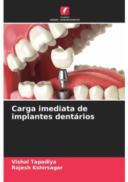 Carga imediata de implantes dentários