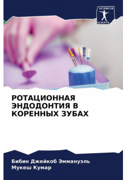 РОТАЦИОННАЯ ЭНДОДОНТИЯ В КОРЕННЫХ ЗУБАХ
