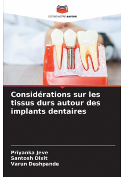 Considérations sur les tissus durs autour des implants dentaires