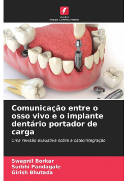Comunicação entre o osso vivo e o implante dentário portador de carga
