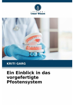 Ein Einblick in das vorgefertigte Pfostensystem