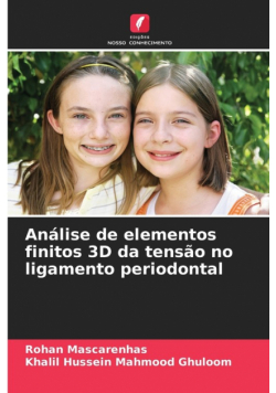 Análise de elementos finitos 3D da tensão no ligamento periodontal