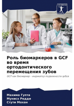 Роль Биомаркеров В Gcf Во Время Ортодонтического Перемещения Зубов