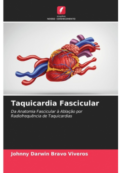Taquicardia Fascicular