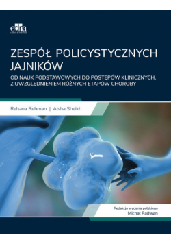 Zespół policystycznych jajników