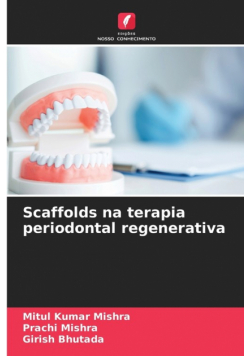 Scaffolds na terapia periodontal regenerativa