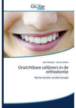Onzichtbare uitlijners in de orthodontie