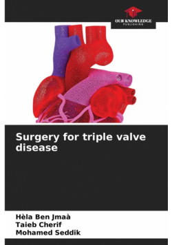 Surgery for triple valve disease