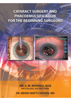 Cataract Surgery And Phacoemulsification For The Beginning Surgeons