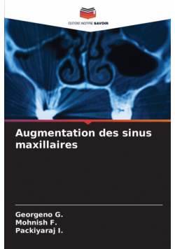 Augmentation des sinus maxillaires