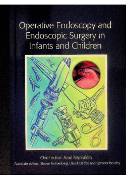 Operative Endoscopy and Endoscopic Surgery in Infants and Children