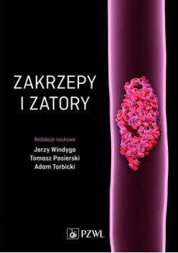 Zakrzepy i zatory