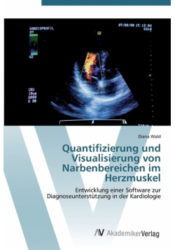 Quantifizierung und Visualisierung von Narbenbereichen im Herzmuskel