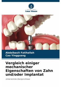 Vergleich einiger mechanischer Eigenschaften von Zahn und/oder Implantat