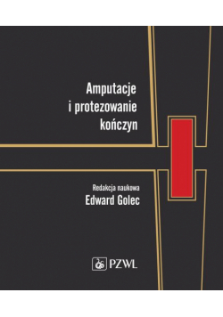Amputacje i protezowanie kończyn