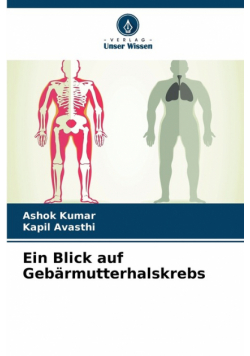 Ein Blick auf Gebärmutterhalskrebs