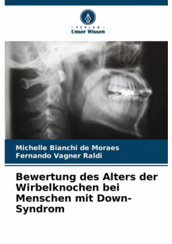 Bewertung des Alters der Wirbelknochen bei Menschen mit Down-Syndrom