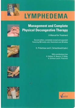Lymphedema Management and Complete Physical Decongesitive Therapy