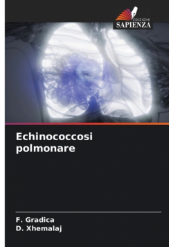 Echinococcosi polmonare
