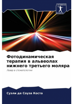 Фотодинамическая терапия в альвеолах нижнего третьего моляра