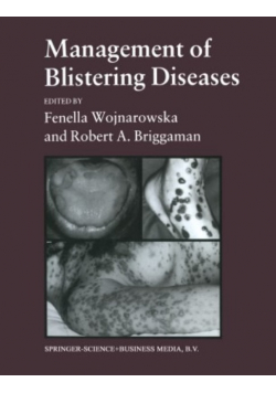 Management of Blistering Diseases