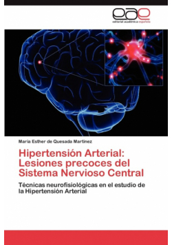 Hipertensión Arterial