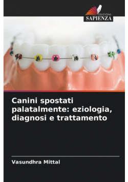 Canini spostati palatalmente