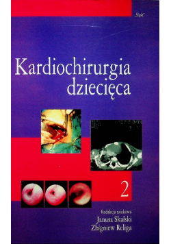 Kardiochirurgia dziecięca Tom 2