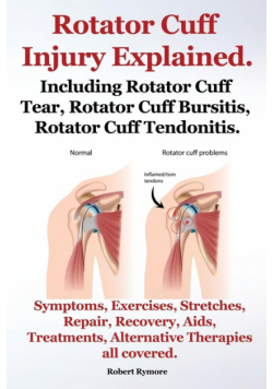 Rotator Cuff Injury Explained. Including Rotator Cuff Tear, Rotator Cuff Bursitis, Rotator Cuff Tendonitis. Symptoms, Exercises, Stretches, Repair, Re