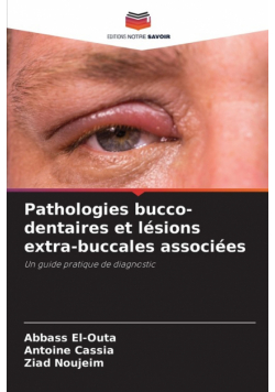 Pathologies bucco-dentaires et lésions extra-buccales associées