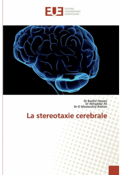 La stereotaxie cerebrale