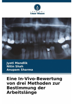 Eine In-Vivo-Bewertung von drei Methoden zur Bestimmung der Arbeitslänge