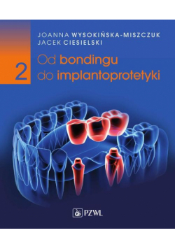 Od bondingu do implantoprotetyki Część 2
