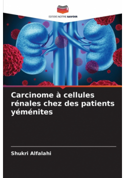 Carcinome à cellules rénales chez des patients yéménites