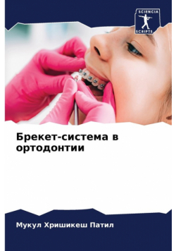 Брекет-система в ортодонтии