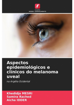Aspectos epidemiológicos e clínicos do melanoma uveal