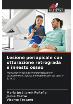 Lesione periapicale con otturazione retrograda e innesto osseo
