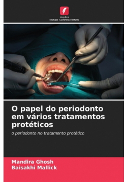 O papel do periodonto em vários tratamentos protéticos