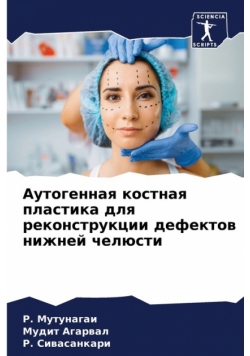 Аутогенная костная пластика для реконструкции дефектов нижней челюсти