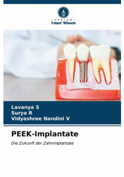PEEK-Implantate