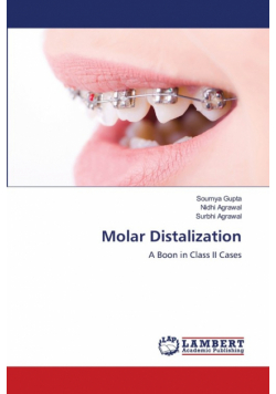 Molar Distalization