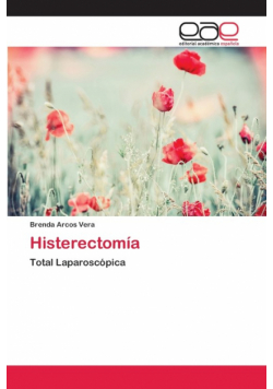 Histerectomía