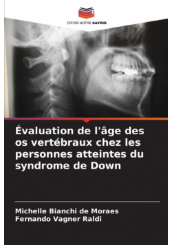 Évaluation de l'âge des os vertébraux chez les personnes atteintes du syndrome de Down